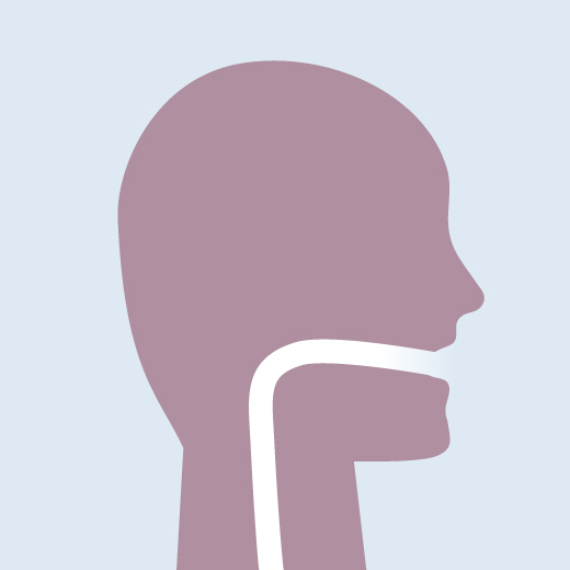 Graphic illustration of intubation
